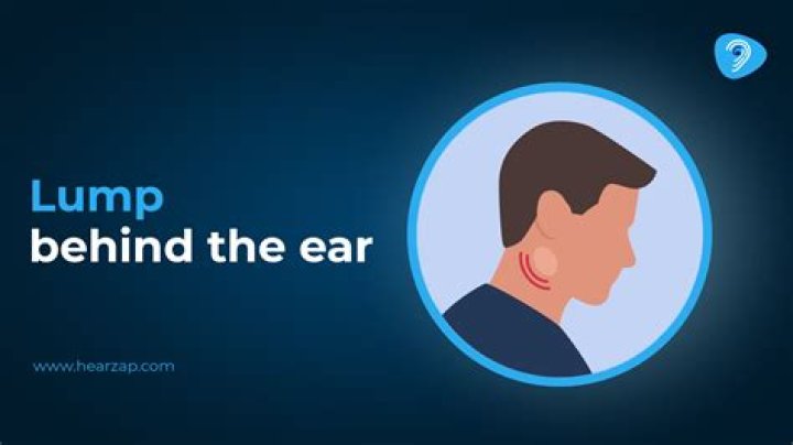 Cillian Murphy: Insight Into A Mysterious Lump Behind His Right Ear
