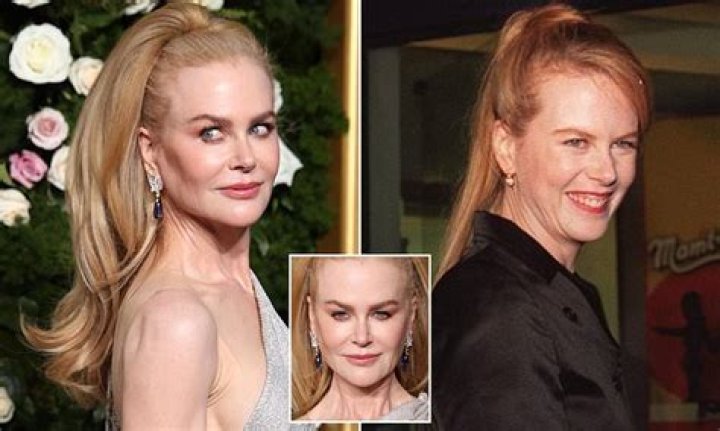 Expert Insights: Has Nicole Kidman Embraced Cosmetic Surgery Procedures?