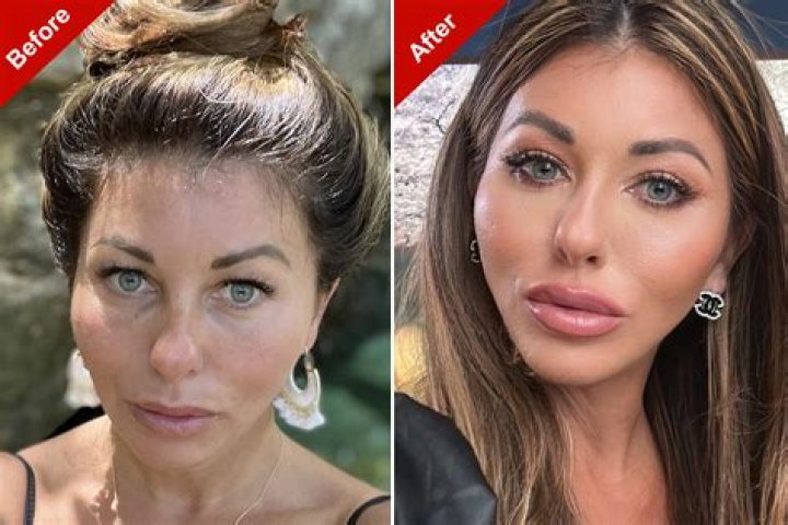 Has Garnacho Undergone Cosmetic Surgery? The Truth Revealed