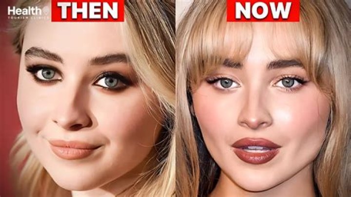 Has Sabrina Undergone Plastic Surgery: The Untold Truth Revealed
