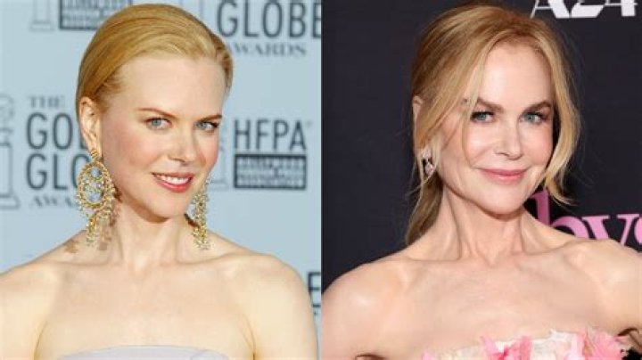 Is Nicole Kidman's Plastic Surgery Too Much?