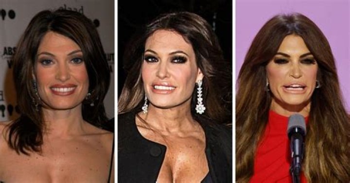 Kimberly Guilfoyle's Stunning Transformation: Unveiling The Secrets Of Her Face Lift