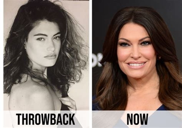 Kimberly Guilfoyle's Transformation: Before And After Pics Unveiled