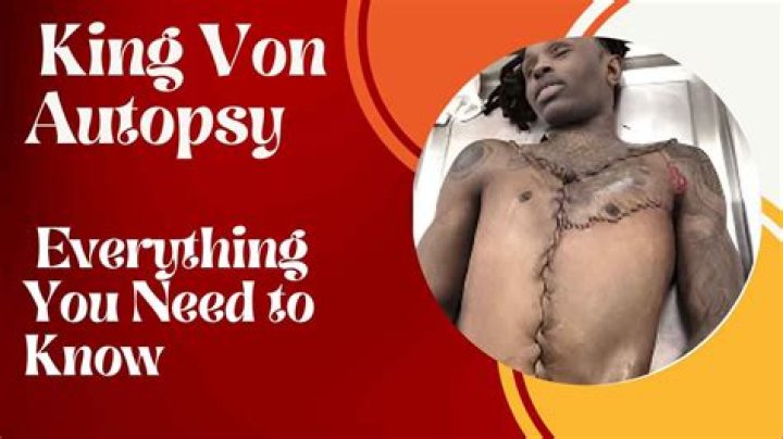 The Tragic Demise Of King Von: Autopsy Reveals Startling Details