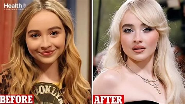 The Truth Unveiled: Did Sabrina Carpenter Undergo Plastic Surgery?