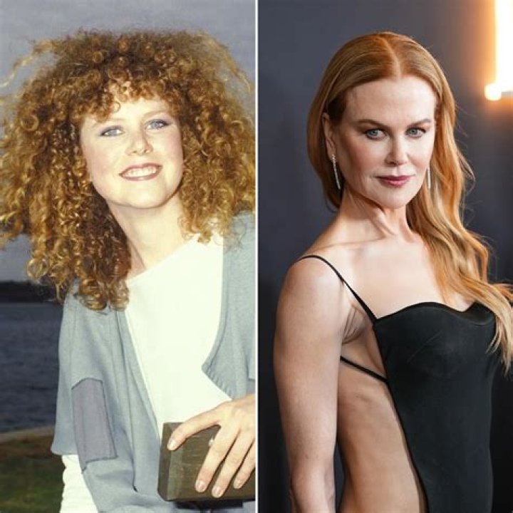 Unveiling Nicole Kidman's Stunning Transformation: Plastic Surgery Enhancing Her Beauty